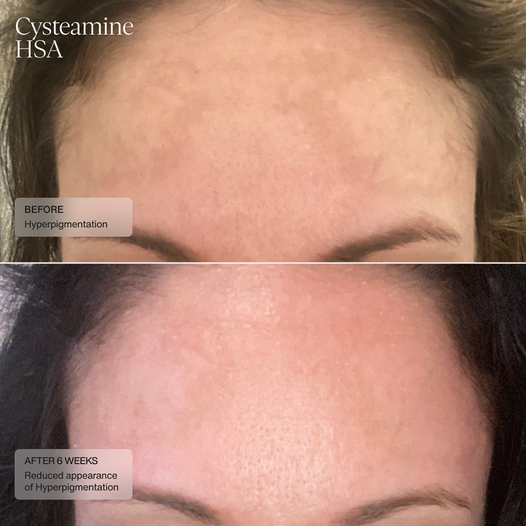 Cysteamine HSA Pigment & Tone Corrector