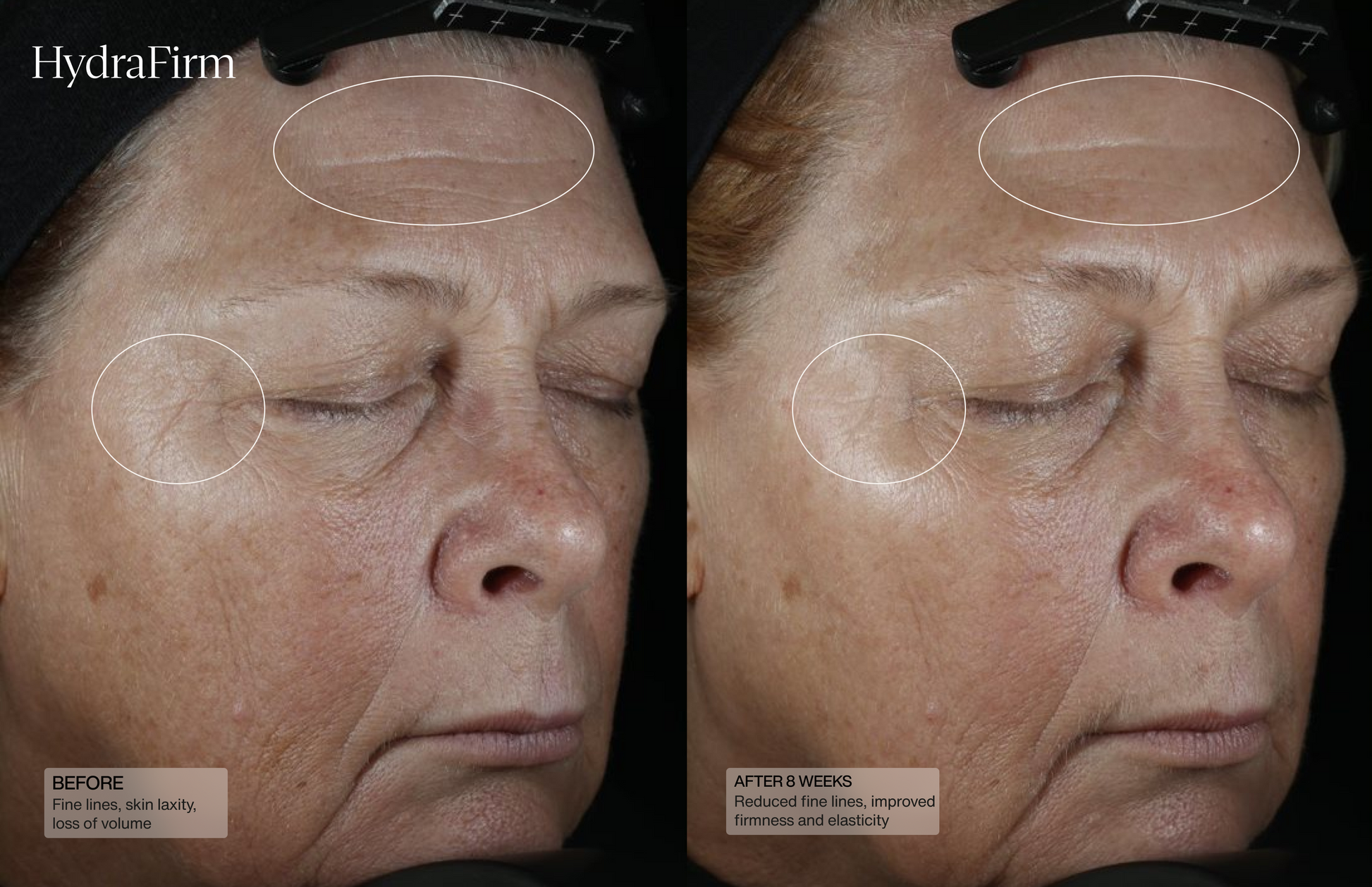 Hydrafirm (Dermal Contour Pressed Serum)