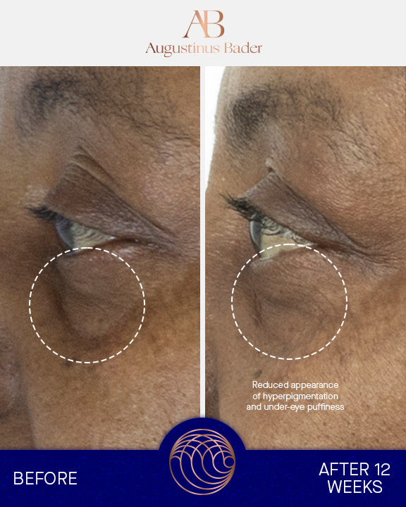 The Eye Cream Nomad 15 ml